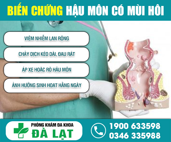 Hình ảnh minh họa